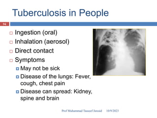 Tuberculosis in People
 Ingestion (oral)
 Inhalation (aerosol)
 Direct contact
 Symptoms
 May not be sick
 Disease of the lungs: Fever,
cough, chest pain
 Disease can spread: Kidney,
spine and brain
10/9/2023
94
Prof Muhammad Tauseef Jawaid
 