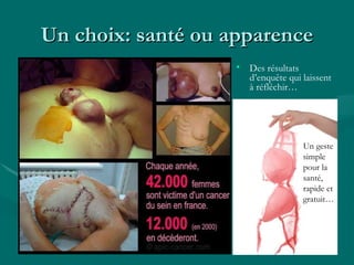 Un choix: santé ou apparence Des résultats d’enquête qui laissent à réfléchir… Un geste simple pour la santé, rapide et gratuit… 