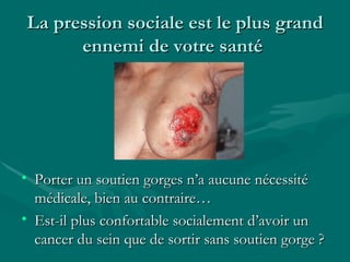 La pression sociale est le plus grand ennemi de votre santé  Porter un soutien gorges n’a aucune nécessité médicale, bien au contraire… Est-il plus confortable socialement d’avoir un cancer du sein que de sortir sans soutien gorge ? 