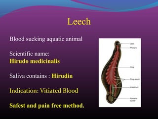 Limatic Leech therapy | PPT