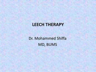 LEECH THERAPY
Dr. Mohammed Shiffa
MD, BUMS
 