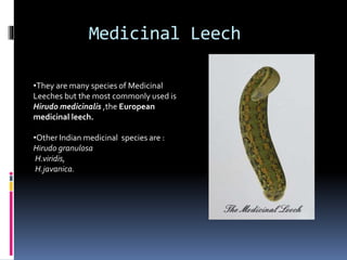 Irsal e Alaq (Leech Therapy)