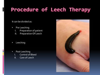 Irsal e Alaq (Leech Therapy)