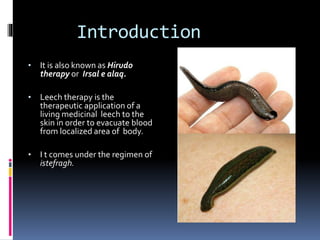 Irsal e Alaq (Leech Therapy)