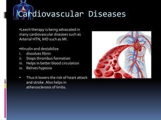 Irsal e Alaq (Leech Therapy)