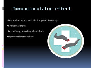Irsal e Alaq (Leech Therapy)