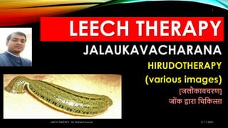 LEECH THERAPY
JALAUKAVACHARANA
HIRUDOTHERAPY
(various images)
[जलौकावचरण]
ज ोंक द्वारा चचचकत्सा
11-11-2021
LEECH THERAPY - Dr Mahesh Kumar
1
 