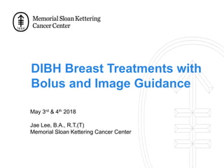DIBH Breast Treatments with
Bolus and Image Guidance
May 3rd & 4th 2018
Jae Lee, B.A., R.T.(T)
Memorial Sloan Kettering Cancer Center
 