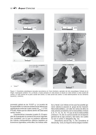 40 Arqueo·Ciencias
Figura 1. Caracteres osteológicos sexuales secundarios en Canis familiaris, ejemplar del sitio arqueológico Cañada de la
Virgen, Guanajuato (entierro 13). a) báculo o hueso peneano en vista dorsal; b) báculo en vista ventral; c) vista caudal del
cráneo; d) vista ventral de la parte caudal del cráneo; e) vista dorsal del cráneo; f) vista lateral-posterior de los dentarios
izquierdo y derecho.
promedio global es de 15,037 g. La prueba de
Kruskal-Wallis no indica la existencia de diferencias
significativas entre las cuatro series (H0.95,3
= 2.733;
P=0.60). Notar que los valores dentro de cada serie
varían mucho
Características craneales (cuadro 5). El ejem-
plar de Guanajuato no conservó los arcos cigomáti-
cos completos, por lo que no pudieron aplicarse
los índices craneométricos clásicos basados en
la anchura cigomática, entre ellos, los índices cefá-
lico y facial. Los índices en los que fue posible ge-
nerar valores lo asocian al grupo de los mesocé-
falos-dolicocéfalos, y el valor de varios de ellos es
más próximo al extremo de la mesocefalia (índices
5, 6, 11, 12, 14, 16, 17) que al de la dolicocefalia
(índices 4, 19, 20); lo cual es acorde con el aspecto
general de la caja craneal y del rostro, los cuales
no son ni cortos ni alargados (fig. 1e).
Dimorfismo sexual (fig. 1). Sin considerar el
báculo (fig. 1a-b), la mayoría de los rasgos morfoló-
 