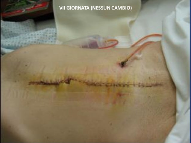 Crema per massaggio di un petto femminile