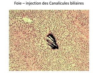 Foie – injection des Canalicules biliaires
 
