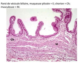 Paroi de vésicule biliaire, muqueuse plissée = E; chorion = Ch;
musculeuse = M.



          E




        Ch
                                                 M
 