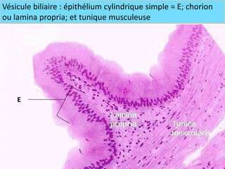 Vésicule biliaire : épithélium cylindrique simple = E; chorion
ou lamina propria; et tunique musculeuse




    E
 