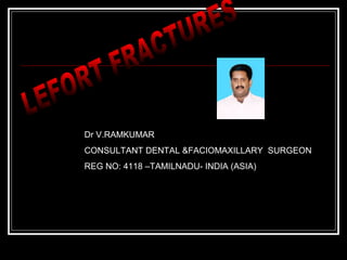 Dr V.RAMKUMAR 
CONSULTANT DENTAL &FACIOMAXILLARY SURGEON 
REG NO: 4118 –TAMILNADU- INDIA (ASIA) 
 