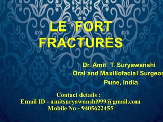 LE FORT 
FRACTURES 
Dr. Amit T. Suryawanshi 
Oral and Maxillofacial Surgeon 
Pune, India 
Contact details : 
Email ID - amitsuryawanshi999@gmail.com 
Mobile No - 9405622455 
 