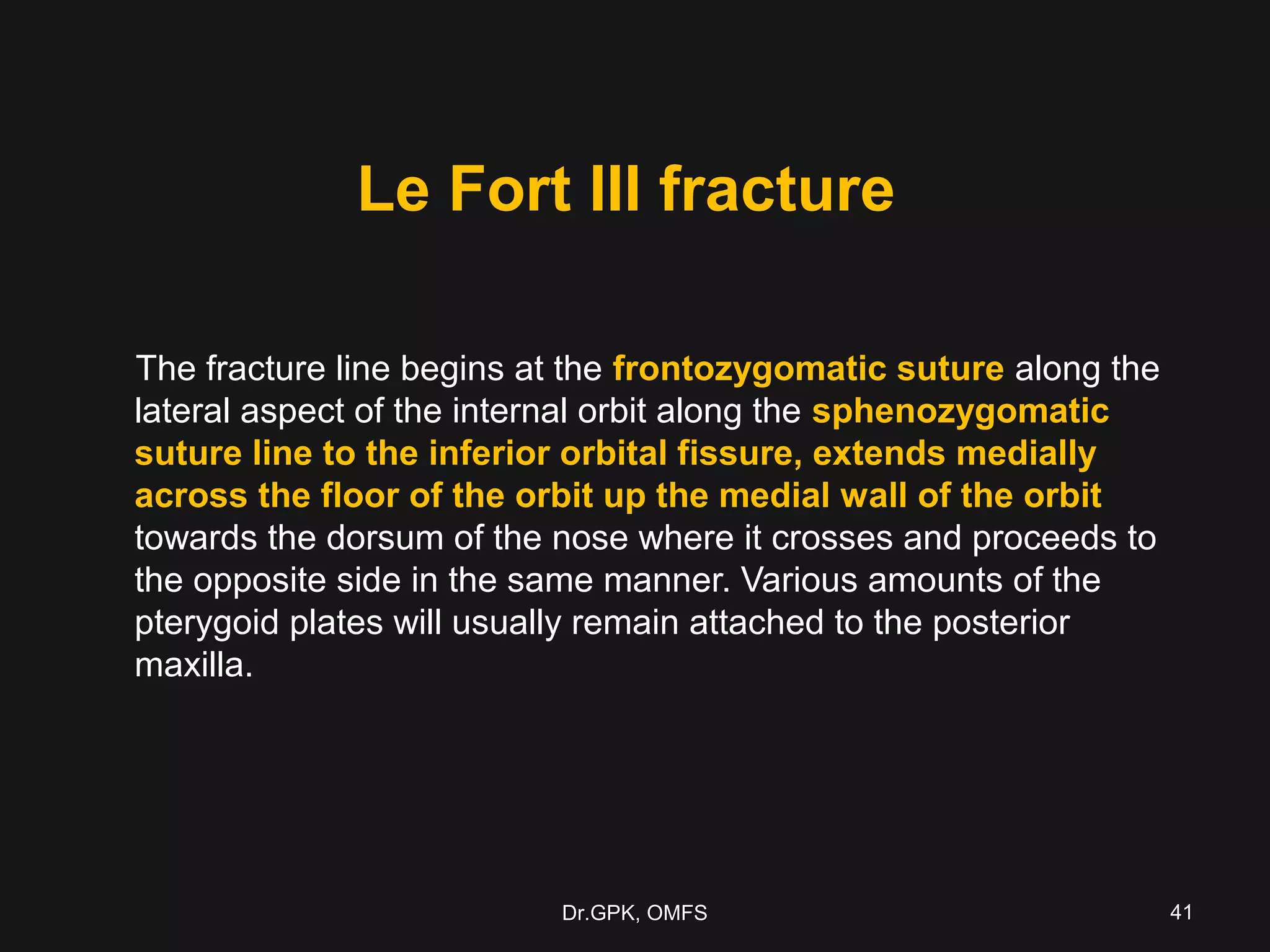Le fort fractures | PPT