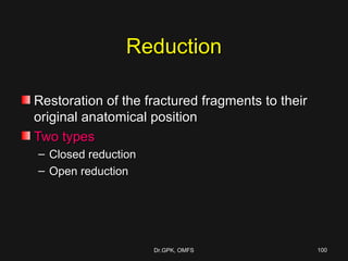 Le fort fractures | PPT