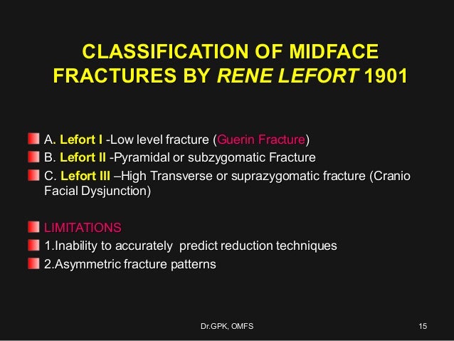 lefort fracture
