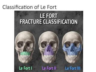 Le Fort Fractures.pptx data collection book | PPTX