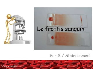 SS//AAbbddeessseemmeedd 
Le frottis sanguin 
Par S / Abdessemed 
 