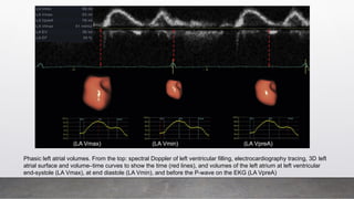 Phasic left atrial volumes. From the top: spectral Doppler of left ventricular filling, electrocardiography tracing, 3D left
atrial surface and volume–time curves to show the time (red lines), and volumes of the left atrium at left ventricular
end-systole (LA Vmax), at end diastole (LA Vmin), and before the P-wave on the EKG (LA VpreA)
LA Vmax
(LA Vmax) (LA Vmin) (LA VpreA)​
 