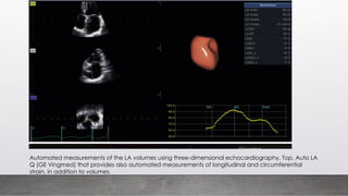 Automated measurements of the LA volumes using three-dimensional echocardiography. Top, Auto LA
Q (GE Vingmed) that provides also automated measurements of longitudinal and circumferential
strain, in addition to volumes.
 