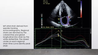 left atrial strain derived from
speckle tracking
echocardiography. Regional
strains are denoted by the
colored lines and global
longitudinal (GL) strain by the
white dotted line. The closed
circles on each regional
strain–time curve identify peak
strain
 