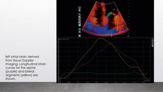 left atrial strain derived
from tissue Doppler
imaging. Longitudinal strain
curves for the septal
(purple) and lateral
segments (yellow) are
shown.
 