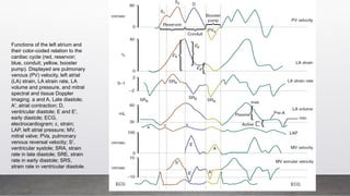 Functions of the left atrium and
their color-coded relation to the
cardiac cycle (red, reservoir;
blue, conduit; yellow, booster
pump). Displayed are pulmonary
venous (PV) velocity, left atrial
(LA) strain, LA strain rate, LA
volume and pressure, and mitral
spectral and tissue Doppler
imaging. a and A, Late diastole;
A′, atrial contraction; D,
ventricular diastole; E and E′,
early diastole; ECG,
electrocardiogram; ε, strain;
LAP, left atrial pressure; MV,
mitral valve; PVa, pulmonary
venous reversal velocity; S′,
ventricular systole; SRA, strain
rate in late diastole; SRE, strain
rate in early diastole; SRS,
strain rate in ventricular diastole.
 