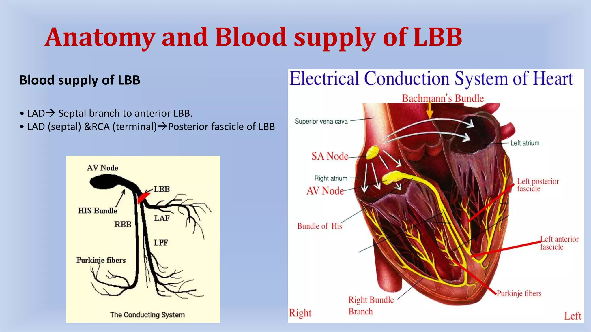Left Bundle Branch Block (LBBB) | PPTX