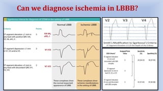 Can we diagnose ischemia in LBBB?
 