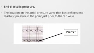 • End-diastolic pressure.
• The location on the atrial pressure wave that best reflects end-
diastolic pressure is the point just prior to the "C" wave.
 