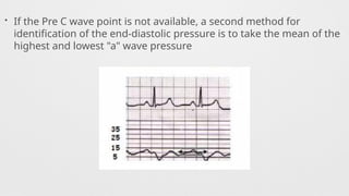 • If the Pre C wave point is not available, a second method for
identification of the end-diastolic pressure is to take the mean of the
highest and lowest "a" wave pressure
 