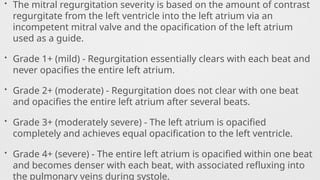 • The mitral regurgitation severity is based on the amount of contrast
regurgitate from the left ventricle into the left atrium via an
incompetent mitral valve and the opacification of the left atrium
used as a guide.
• Grade 1+ (mild) - Regurgitation essentially clears with each beat and
never opacifies the entire left atrium.
• Grade 2+ (moderate) - Regurgitation does not clear with one beat
and opacifies the entire left atrium after several beats.
• Grade 3+ (moderately severe) - The left atrium is opacified
completely and achieves equal opacification to the left ventricle.
• Grade 4+ (severe) - The entire left atrium is opacified within one beat
and becomes denser with each beat, with associated refluxing into
the pulmonary veins during systole.
 