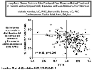 Long-Term Clinical Outcome After Fractional Flow Reserve–Guided Treatment
     in Patients With Angiographically Equivocal Left Main Coronary Artery Stenosis

              Michalis Hamilos, MD, PhD*; Bernard De Bruyne, MD, PhD
                      Cardiovascular Centre Aalst, Aalst, Belgium




   Scatterplots
  mostrando la
 distribución del
  porcentaje de
    estenosis
  y los valores
correspondientes
   de la RFFM




Hamilos, M. et al. Circulation 2009;120:1505-1512
 