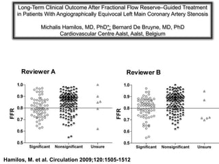 Long-Term Clinical Outcome After Fractional Flow Reserve–Guided Treatment
     in Patients With Angiographically Equivocal Left Main Coronary Artery Stenosis

              Michalis Hamilos, MD, PhD*; Bernard De Bruyne, MD, PhD
                      Cardiovascular Centre Aalst, Aalst, Belgium

                              Relation between FFR values and the
                                 2 reviewers' visual estimations
               (lesions were classified as significant, nonsignificant, and unsure)




Hamilos, M. et al. Circulation 2009;120:1505-1512
 