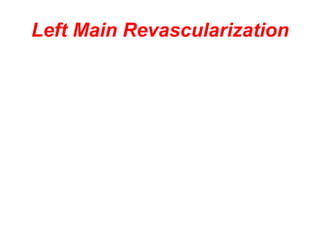 Left Main Revascularization
 