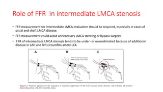 Role of FFR in intermediate LMCA stenosis
• FFR measurement for intermediate LMCA evaluation should be required, especially in cases of
ostial and shaft LMCA disease.
• FFR measurement could avoid unnecessary LMCA stenting or bypass surgery.
• FFR of intermediate LMCA stenosis tends to be under- or overestimated because of additional
disease in LAD and left circumflex artery LCX.
 