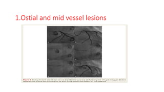 1.Ostial and mid vessel lesions
 