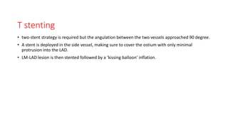 T stenting
• two-stent strategy is required but the angulation between the two vessels approached 90 degree.
• A stent is deployed in the side vessel, making sure to cover the ostium with only minimal
protrusion into the LAD.
• LM-LAD lesion is then stented followed by a ‘kissing balloon’ inflation.
 