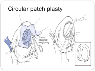 Circular patch plasty
 