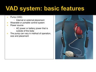    Pump (VAD)
        ▪ Internal or external placement
   Wearable or portable control system
   Power source
        ▪ AC power or battery power that is
          outside of the body
   The pump can vary in method of operation,
    size and placement
 