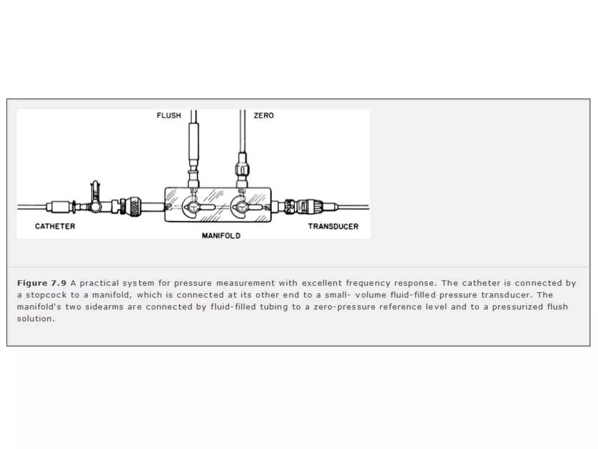 Left ventricular pressure tracings | PPTX