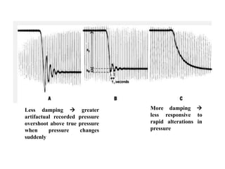 Less damping  greater
artifactual recorded pressure
overshoot above true pressure
when pressure changes
suddenly
More damping 
less responsive to
rapid alterations in
pressure
 