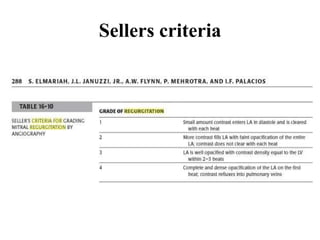 Sellers criteria
 