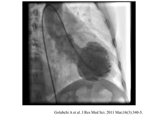 Golabchi A et al. J Res Med Sci. 2011 Mar;16(3):340-5.
 