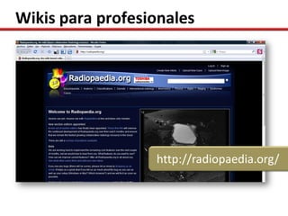 Wikis para profesionales




                  http://radiopaedia.org/
 