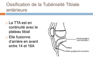 Ossification de la Tubérosité Tibiale 
antérieure 
 La TTA est en 
continuité avec le 
plateau tibial 
 Elle fusionne 
d’arrière en avant 
entre 14 et 16A 
 