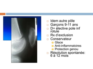  Idem autre pôle 
 Garçons 9-11 ans 
 D+ élective pole inf 
rotule 
 Rx d’exclusion 
 Conservateur 
 Glace 
 Anti-inflammatoires 
 Protection genou 
 Résolution spontanée: 
6 à 12 mois 
 