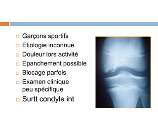  Garçons sportifs 
 Etiologie inconnue 
 Douleur lors activité 
 Epanchement possible 
 Blocage parfois 
 Examen clinique 
peu spécifique 
 Surtt condyle int 
 